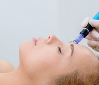 microneedling-treatment-viacosmetic